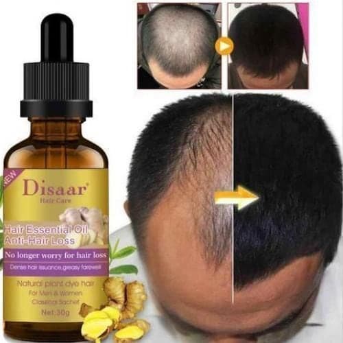 Disaar Disaar Hair Growth Essential Oil - Anti Hair Loss, 50 ml, Unisex, Gold — Display