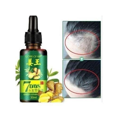 Clothes Of Skin 7Days Ginger Germinal Essential Hair Growth Oil For Hair Loss/Hair Treatment-For Both Men&Women30ml — Display