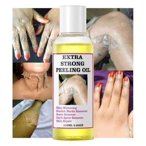 MOOYAM Extra Strong Yellow Peeling Oil Elbow Knees Hands Even Skin — Display