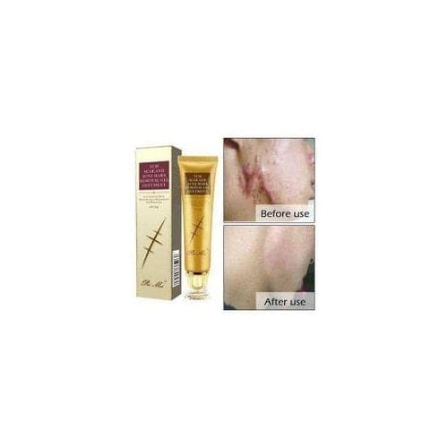 TCM Scar, Acne, Stretch Mark Remover Cream — Display