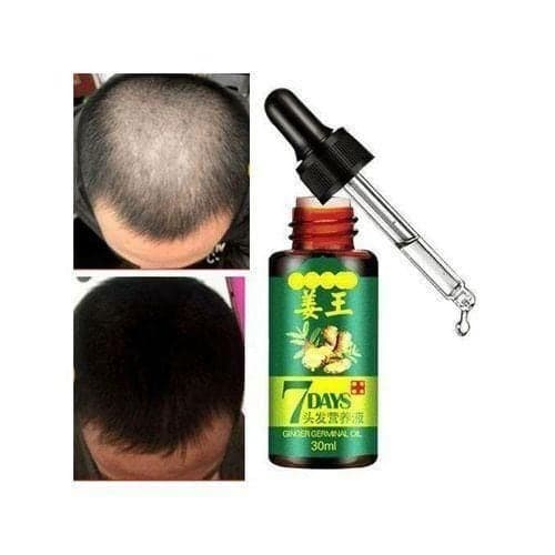 Aichun Beauty 7 Days Hair Tonic Ginger Germinal Regrowth Oil — Display